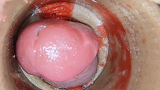 Camera Inside Deep Pussy Captures Big dose Ejaculation of Sperm ASMR