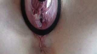 Huge Labia Pussy Pumping for the First Time