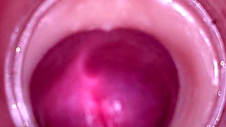 Female Insemination - Internal Camera Captures Deep Male Ejaculation