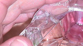 Big Mature Pussy and Cervix Examined with Speculum