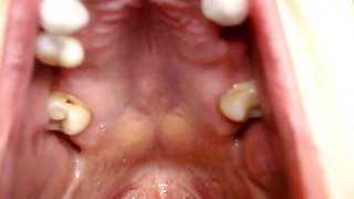 Throat and Mouth Spit Strings Uvula Tonsils Uvula