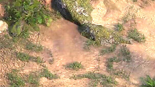 Unexpected Erection in Front of the Nurse