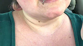 Got a Sunburn for Art Supplies!