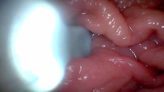 First Time: an Endoscope Reveals the G-spot up Close - Without Mounting!